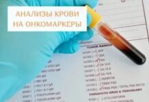 Своевременная сдача анализов: необходимая мера поддержания своего здоровья в хорошем состоянии-