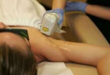 Преимущества лазерной эпиляции