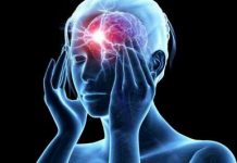 Симптомы мигрени