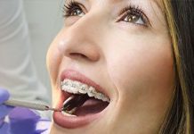 Виды стоматологических услуг