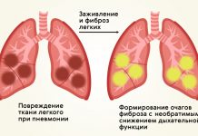 Как перестать курить сигареты навсегда?
