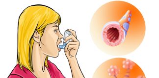 Как оказать первую помощь при бронхоспазме?