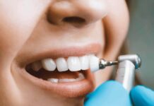 Важность профессиональной гигиены полости рта