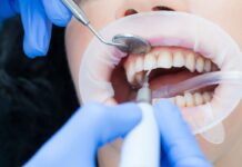 Особенности и этапы профессиональной гигиены полости рта