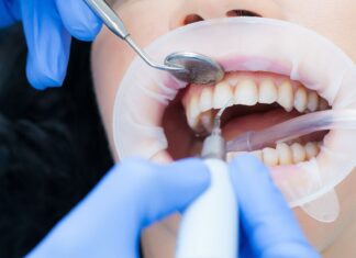 Особенности и этапы профессиональной гигиены полости рта